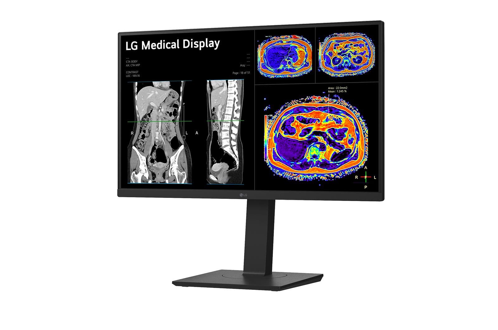 LG 27HS713C-B — miniatura 2