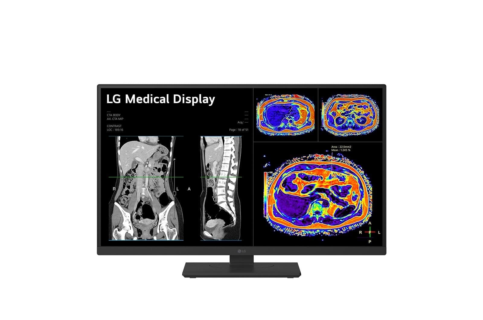 LG 27HS713C-B — miniatura 3