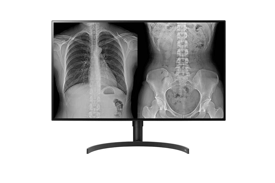 LG 32HL512D-M, 80 cm (31.5"), 3840 x 2160 pixels