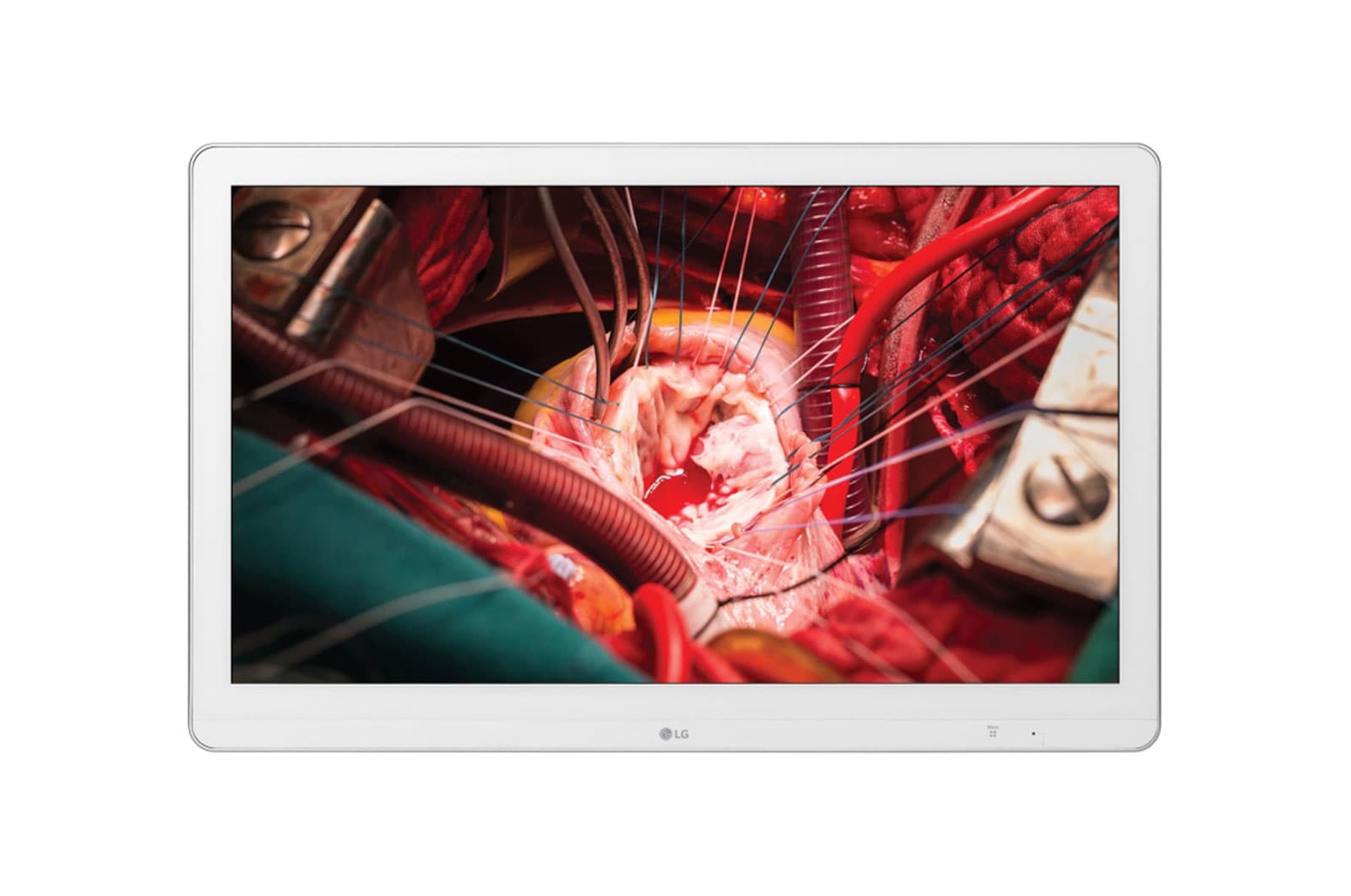 LG 27HK510S-W, 68,6 cm (27"), 1920 x 1080 pixels
