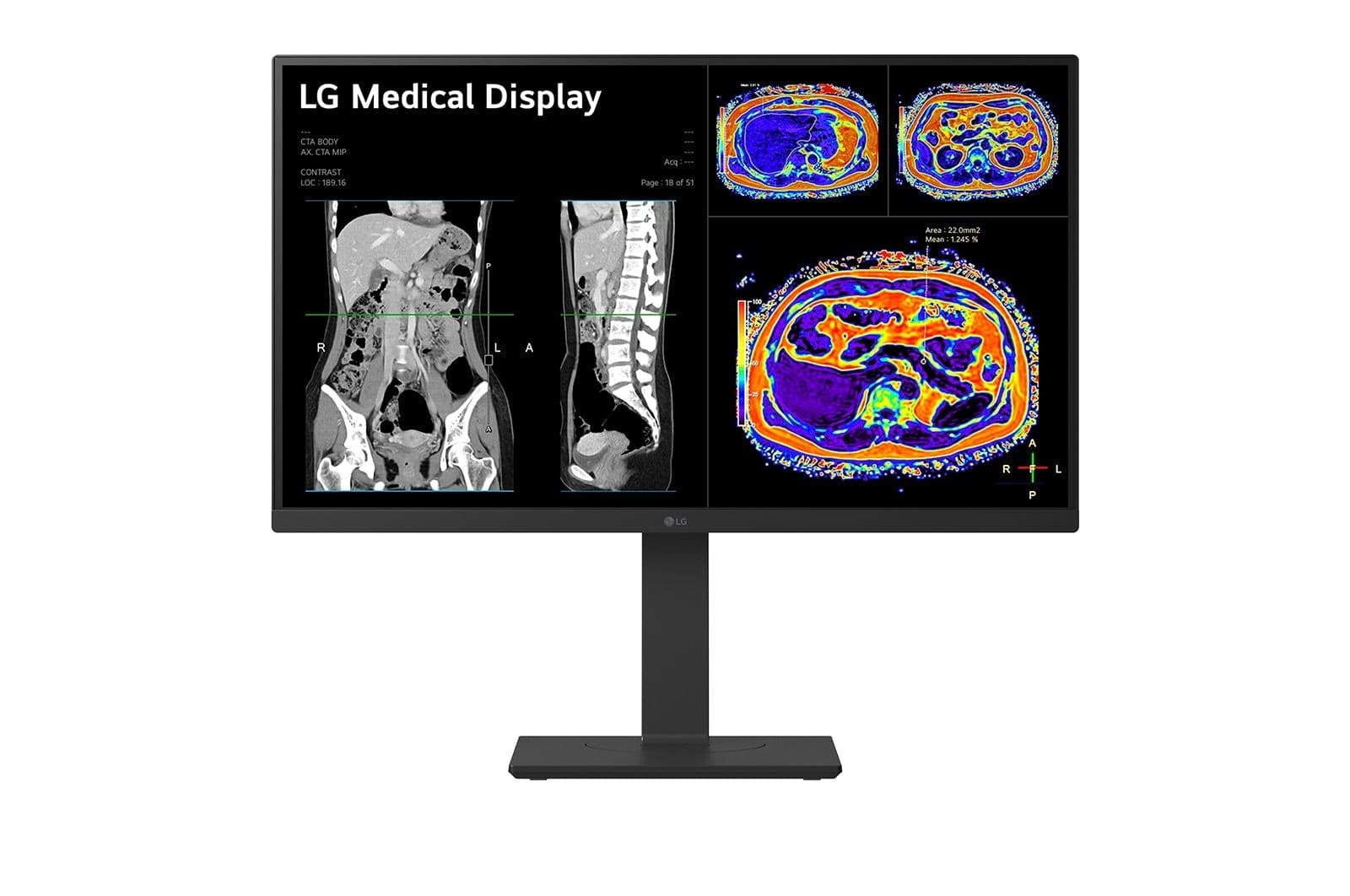 LG 27HS713C-B, 68,6 cm (27"), 3840 x 2160 pixels